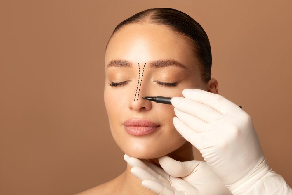 تجميل الأنف