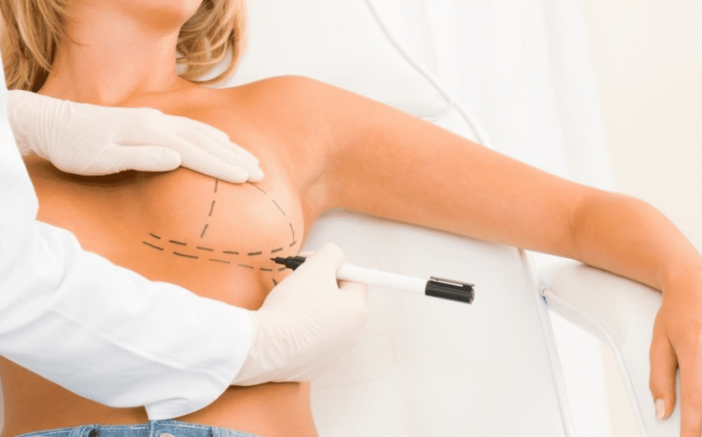عملية تكبير الثدي بالليزر