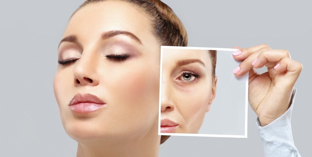 Botox cost 9 تكلفة البوتوكس